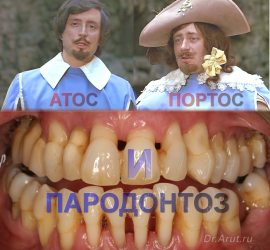 Атос, Портос и Пародонтоз