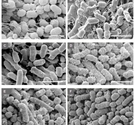Bacteroides intermedius
