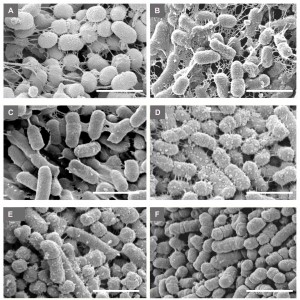 Bacteroides intermedius