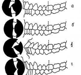 Виды физиологического прикуса
