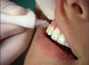 Холодовая проба