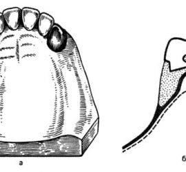 «Наездник»