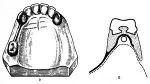 «Наездник»