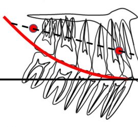 Окклюзионная плоскость