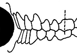 Опистогнатия (бипрогения)