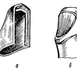 Полукоронка (трехчетвертная коронка)