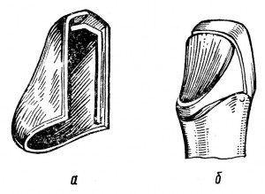 Полукоронка (трехчетвертная коронка)