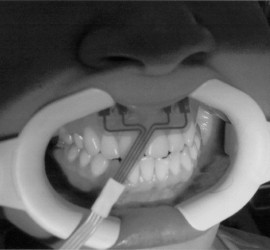 Реопародонтография