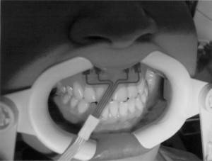 Реопародонтография