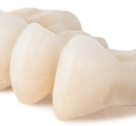 Протез мостовидный временный