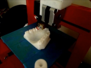3D печать модели челюстей