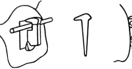 Бегг-техника. Замковое приспособление с горизонтальной прорезью для круглых дуг и шплинт.