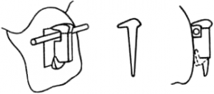 Бегг-техника. Замковое приспособление с горизонтальной прорезью для круглых дуг и шплинт.