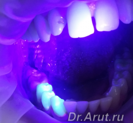 Флюоресцентная диагностика