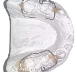 Кламмер Шварца