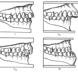 Классы по Энглю