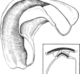 Стандартная вестибулярная пластинка Шонхера.