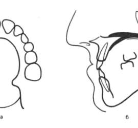 Плавающий обтуратор