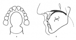 Плавающий обтуратор