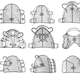 Съемные расширяющие пластинки с винтом