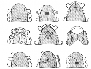 Съемные расширяющие пластинки с винтом