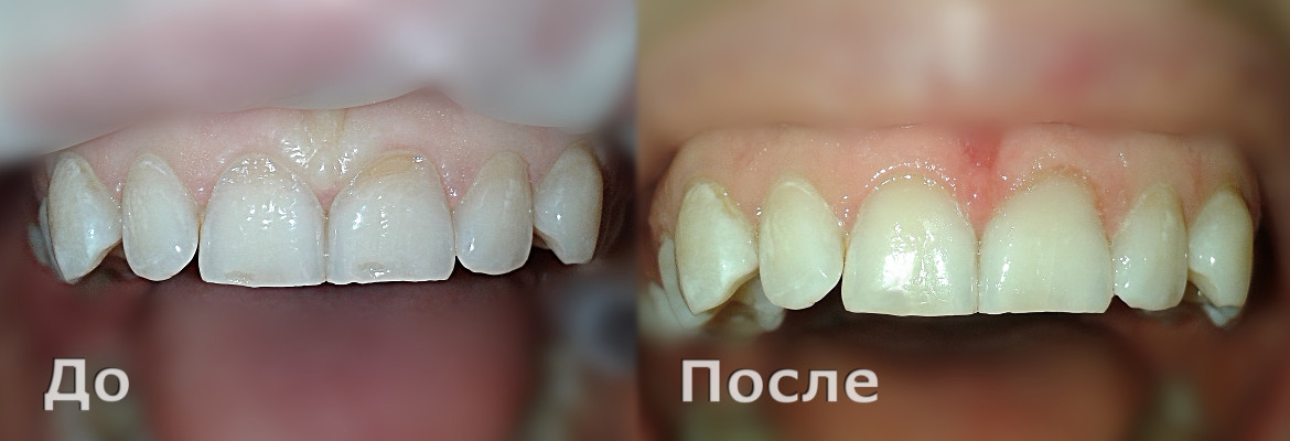 Стоматология — Dr. Arutyun Ervandyan