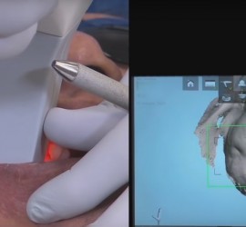 CAD/CAM иммедиат протез