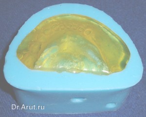 Модель установленная в силиконовую форму