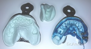 Оттиск с трансферами