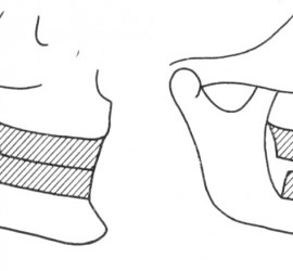 Феномен Христенсена