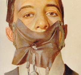 Коффердам, наложенный пациенту