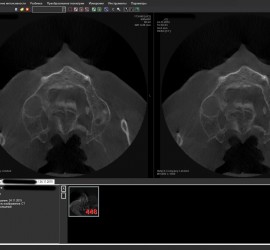 Multivox Dicom Viewer