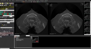 Multivox Dicom Viewer