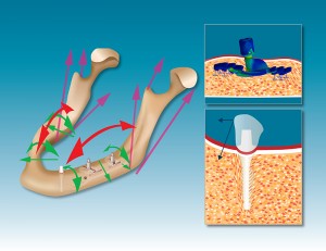 Схема установки PEEK