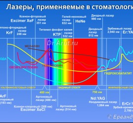 Сравнение лазеров в стоматологии