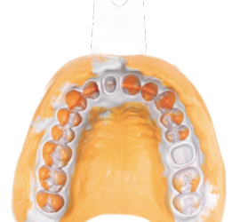 Двухслойный оттиск из А силикона