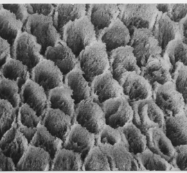 Протравленная ортофосфорной кислотой эмаль под микроскопом.