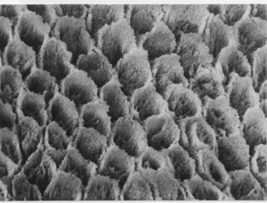 Протравленная ортофосфорной кислотой эмаль под микроскопом.