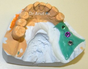 Модель с аналогами