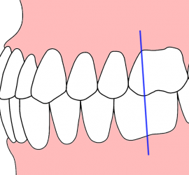 Ортогнатический прикус