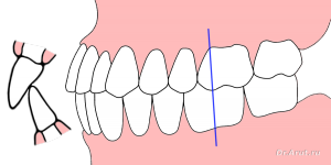 Ортогнатический прикус