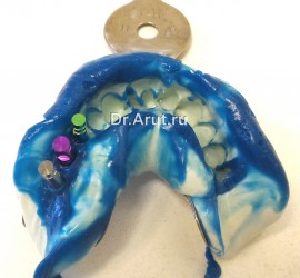 Оттиск с трансферами и аналогом