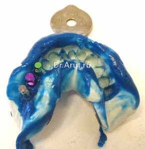 Оттиск с трансферами и аналогом