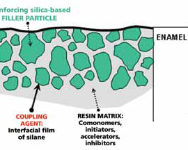 Строение первого стоматологического композита.