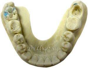 Полиуретановая модель