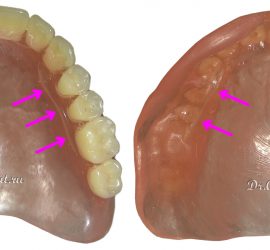 Пористость жадности