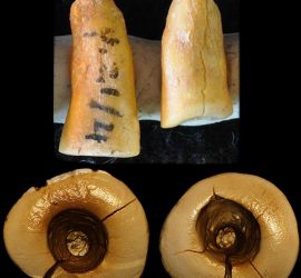 Каналы резцов, запломбированные битумом.