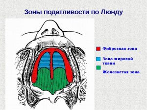 Зоны податливости по Люнду