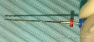 Гной на файле