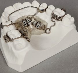 Аппарат Pendulum